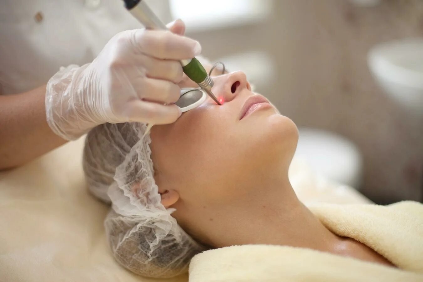 Омоложение сосудов. Косметология. лазерная фотокоагуляция сосудов. фотокоагуляция сосудов на лице. коагуляция сосудов на лице лазером.