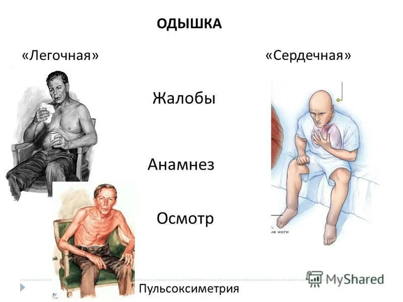 Как отличить сердечную одышку от легочной. Легочная одышка. Сердечная одышка. Отличие сердечной одышки от легочной. Поверхностная одышка