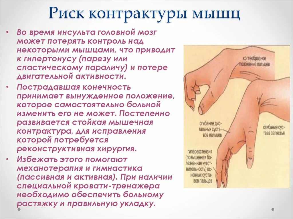 Парез верхних конечностей. Парциальная мышечная контрактура. Возникновение контрактуры.