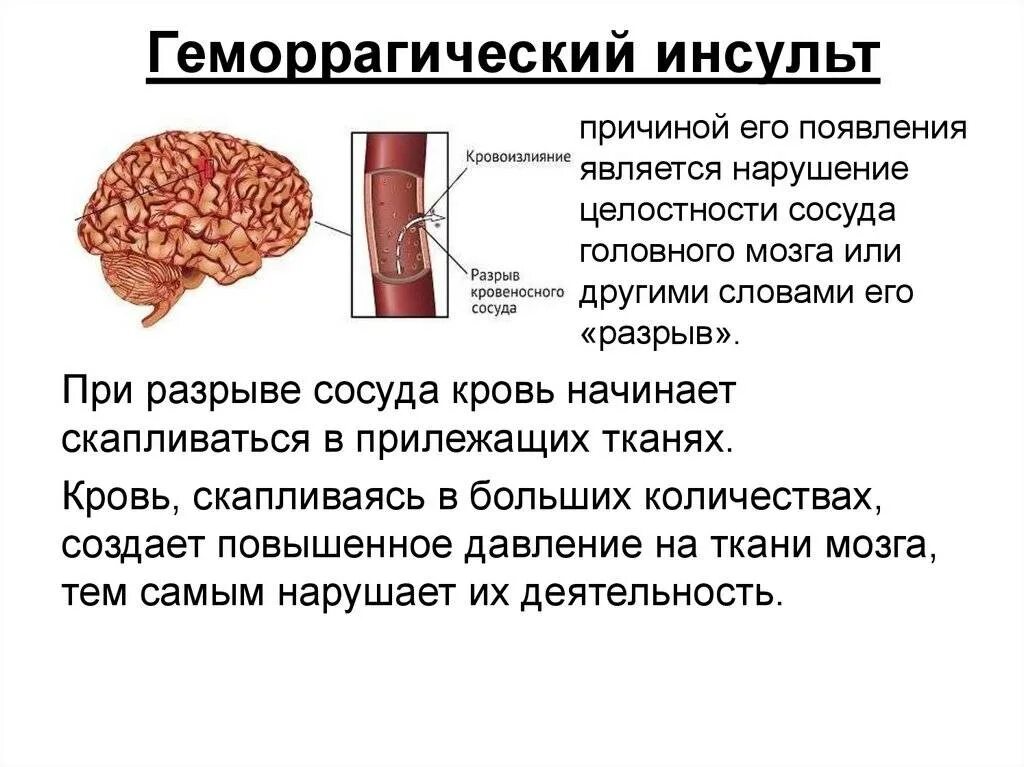 Был геморрагический инсульт