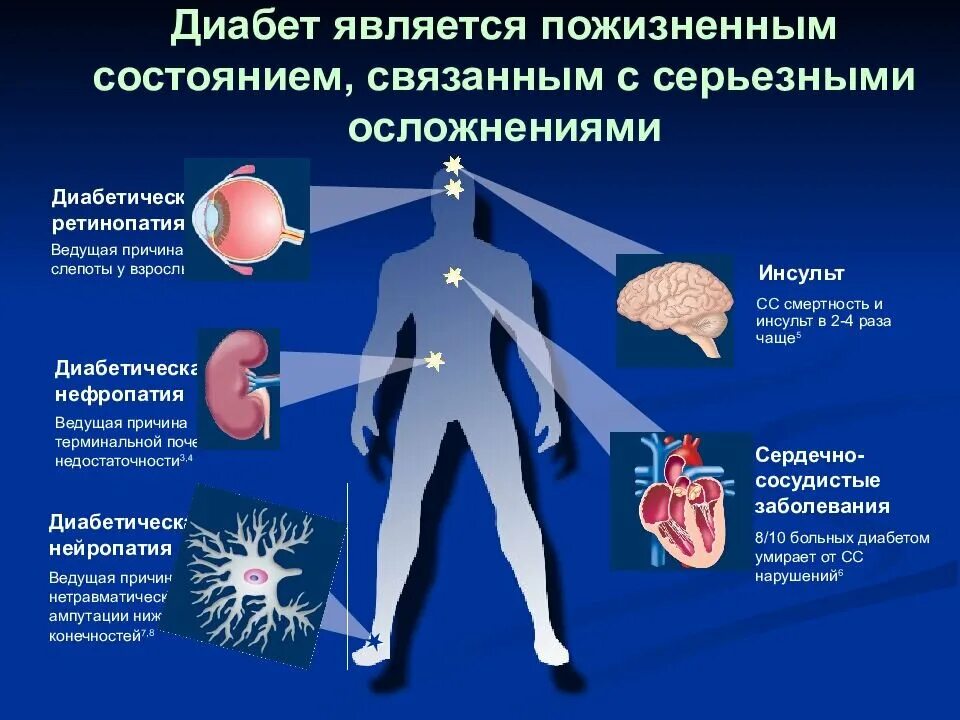 Чем грозит диабет. Осложнения сахарного диабета. Презентация по сахарному диабету. Профилактика осложнений диабета. Сахарный диабет это заболевание.