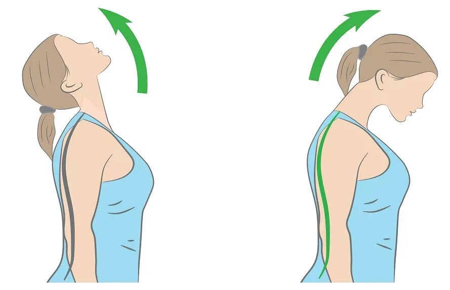 Почему опускаю голову вниз. Наклоны головы. Наклоны головы вперед назад. Упражнение наклоны головы в стороны. Наклон головы вперед.