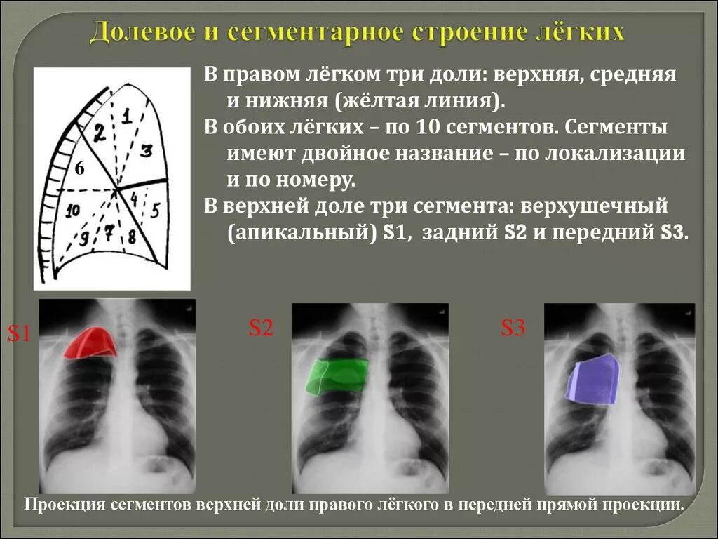 Три доли легкого. Доли правого легкого. Доли легкого на рентгенограмме. Долевое и сегментарное строение легких. Строение легких сегменты и доли.