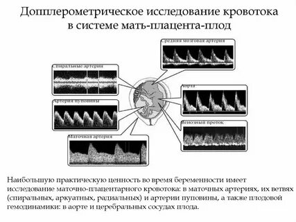 Исследование кровотока