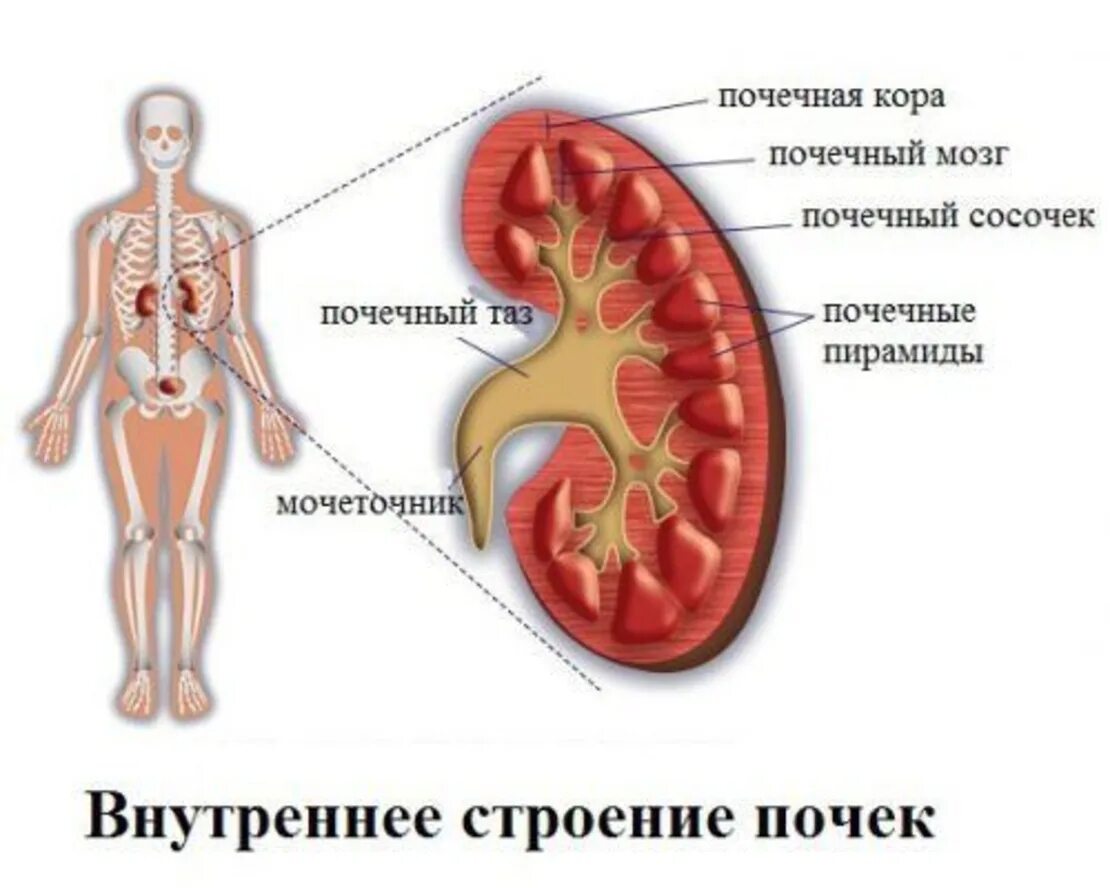 КАМНИТВ почках симптомы. Камни в посках симптом. Камни в почках симптомы у женщин. Ощущаются почки