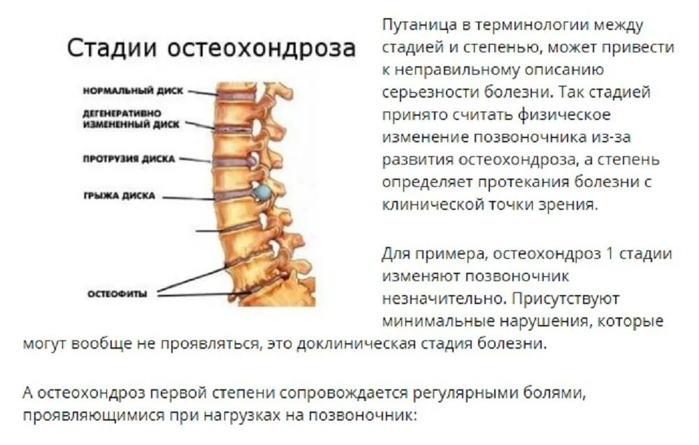 Как лечить поясничного отдела позвоночника. Межпозвонковый остеохондроз шейного отдела 1 -2 стадия. Остеохондроз 2 ст поясничного отдела позвоночника что это такое. Степени остеохондроза поясничного отдела позвоночника. Остеохондроз пояснично-крестцового отдела 2 степени.