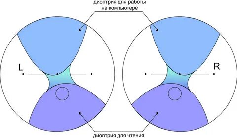Прогрессивные линзы это