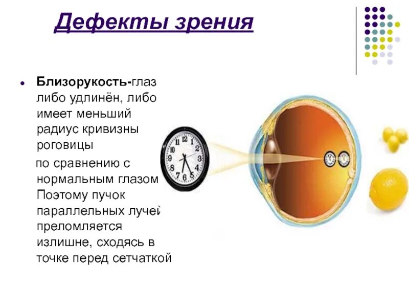 Дефекты зрения как сохранить зрение. Способы коррекции дефектов зрения. Аномалии рефракции глаза близорукость дальнозоркость таблица. Дефекты зрения как сохранить зрение. Дефекты зрения очки.