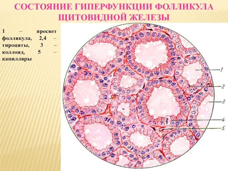 Фолликулы щитовидной железы гистология. Коллоид фолликулов щитовидной железы. Щитовидная железа норма гистология. Щитовидная железа гистология. Три фолликула