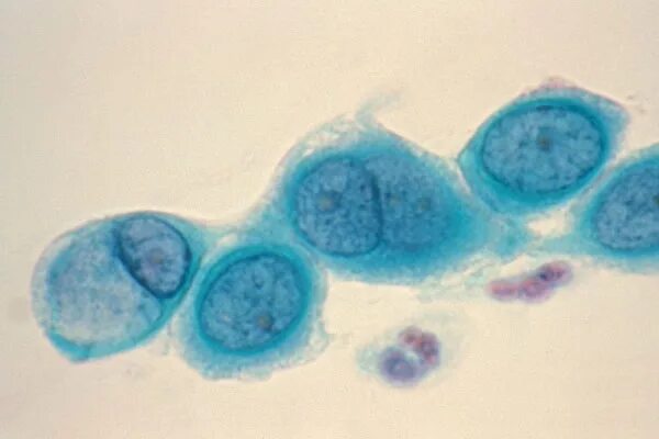 Chlamydia trachomatis. Урогенитальный хламидиоз возбудитель.