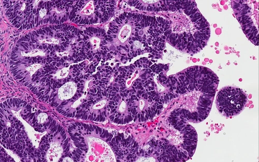 P et al