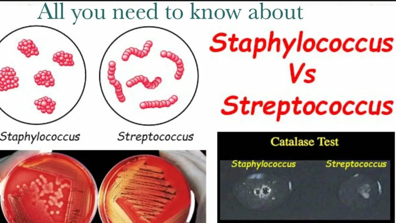 Тест на стрептококки в аптеке. Стафилококки стрептококки энтерококки. Кокки стафилококки стрептококки. Стафилококки и стрептококки. Стрептококков и стафилококков.