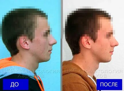 Птичье лицо