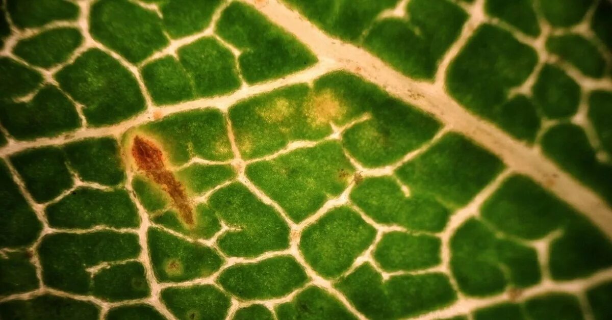 The Third Annual Savage Image Award 2011 Submissions Things under a microscope, 