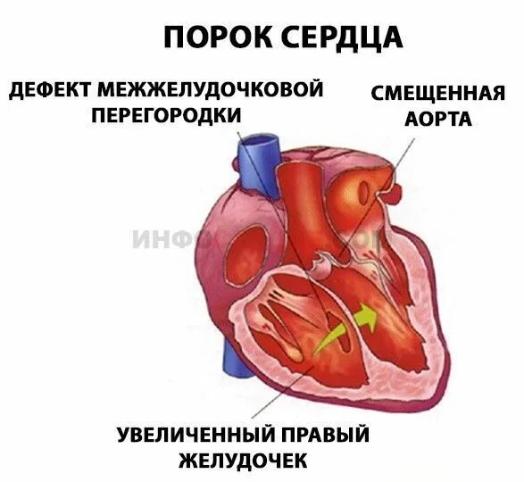 Пороки сердца у животных. Пороки сердца презентация. приобретенные пороки сердца картинки.