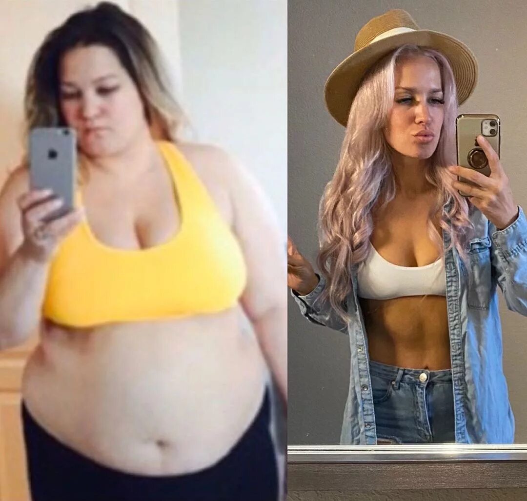 толстый живот до и после похудения. толстые до и после похудения. похудение на 60 кг. люди весящие 60 кг. похудение до и после.