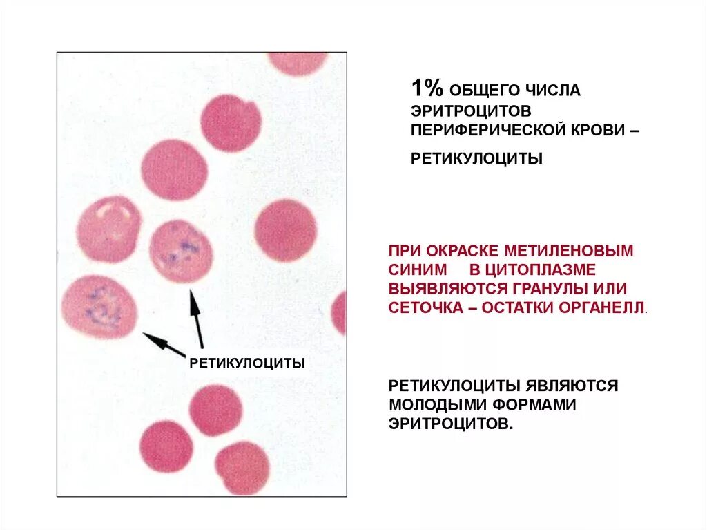 Ретикулоциты в периферической крови. Ретикулоциты в периферической крови в норме. Норма ретикулоцитов в периферической крови. Нормальные показатели ретикулоцитов периферической крови в %. Тельце гейнца