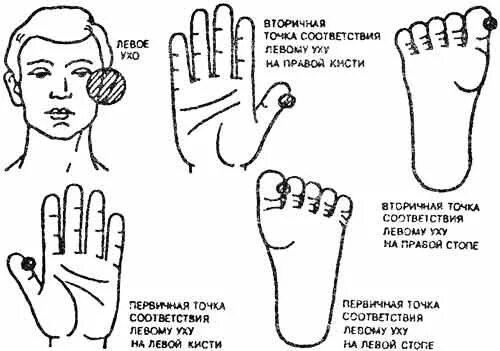 Точки шум в ушах. Су-Джок терапия акупунктурные точки. Су Джок стопа схема. Точки Су Джок при отите. Су Джок точки на ушах.