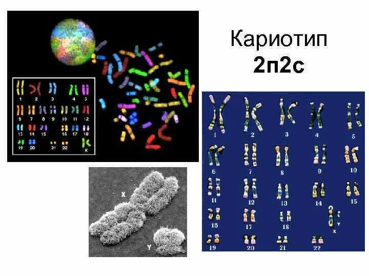 Кариотип человека определяют