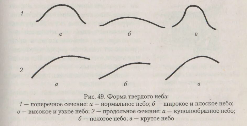 Строение твердого и мягкого неба. Твердое небо куполообразной формы. Ротовая полость с зубами и языком. Твердое и мягкое небо анатомия. Небо в логопедии.