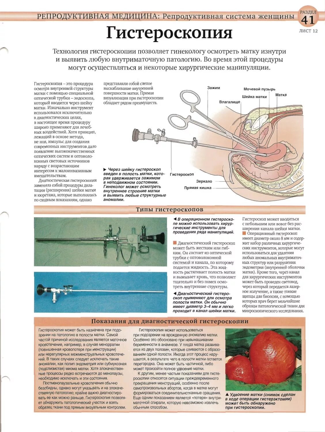 Удаление матки отзывы врачей. Операция гистероскопия. Диагностическая гистероскопия. Показания к диагностической гистероскопии:.