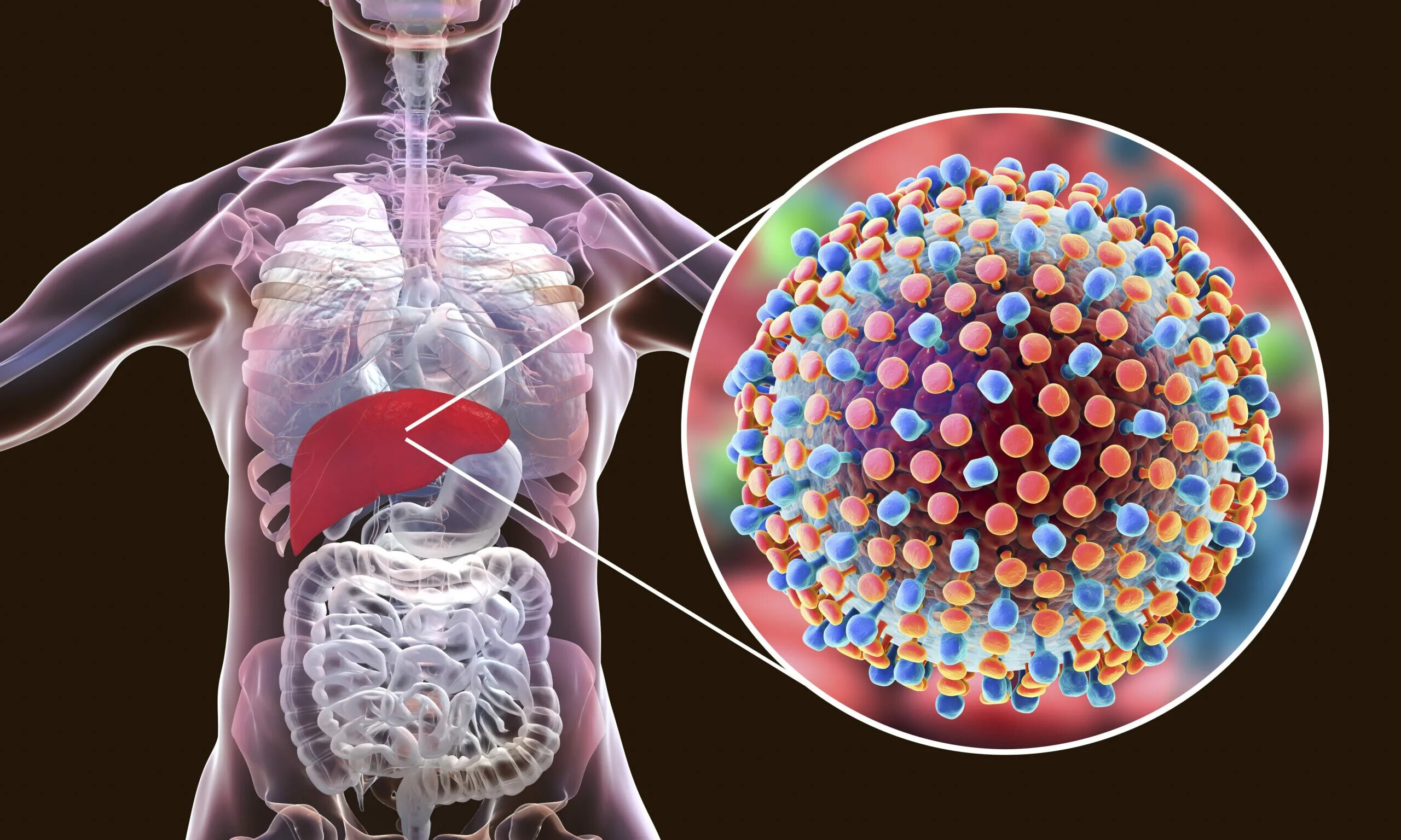 Вирус гепатита c. Вирус гепатита с (HCV). Возбудитель гепатита а. Hcv 1 2