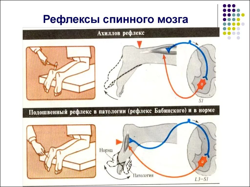 Ахиллов рефлекс рефлекторная. Ахиллов рефлекс физиология. Спинальные сгибательные рефлексы. Классификация двигательных рефлексов спинного мозга.