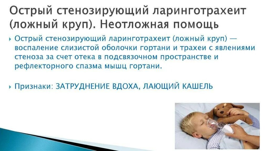 Помощь при крупе. Ложный круп неотложная помощь. круп у детей симптомы и первая помощь. неотложная помощь при ложном крупе. ложный круп у детей первая помощь.