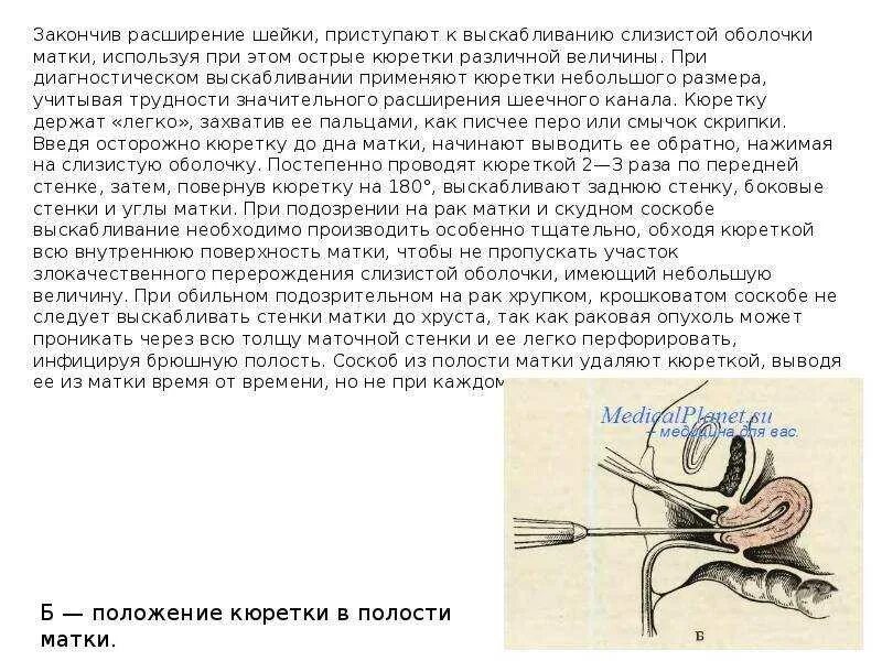 Выделения после осмотра гинеколога