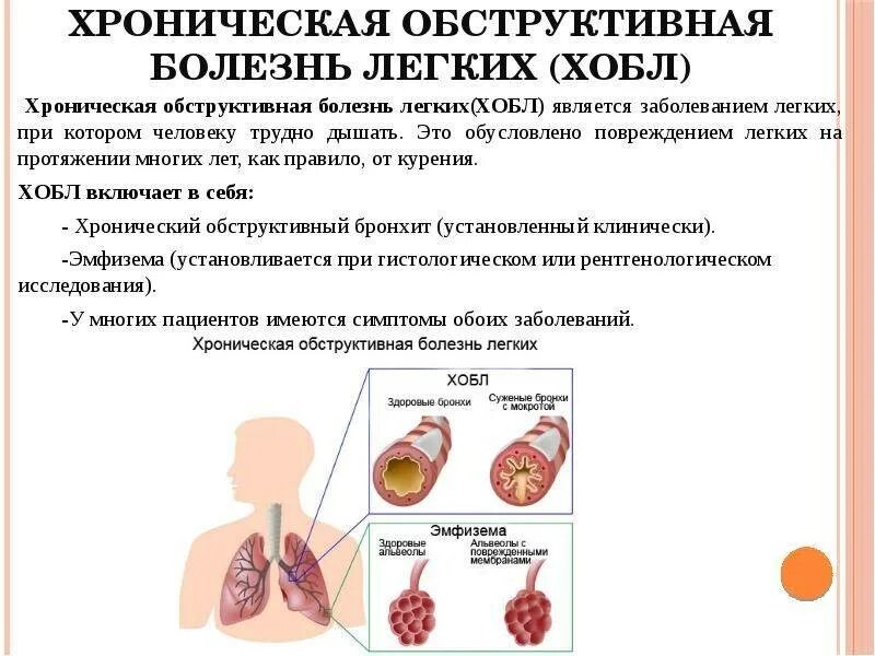 Обструктивной болезни легких хобл