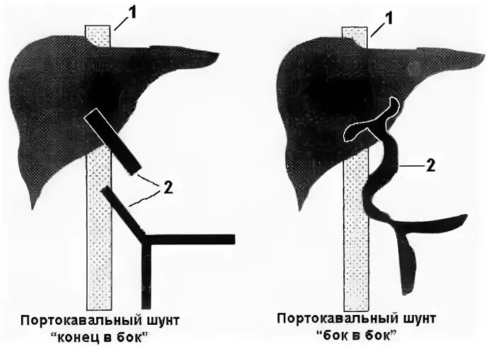 Шунт печени у собак