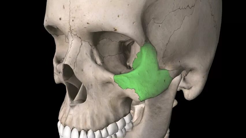 Перелом свода черепа рентген. Перелом костей свода черепа рентген. Срастается ли череп. Симптомы перелома основания черепа рентген. Базилярный перелом черепа.