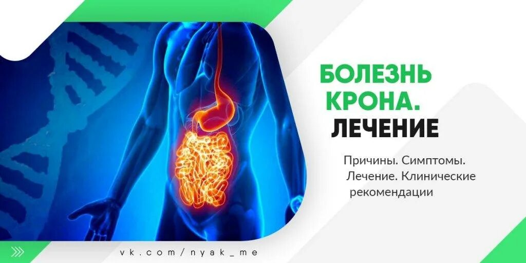 Укрон. Терапия болезни крона. Болезнь крона симптомы у взрослых.