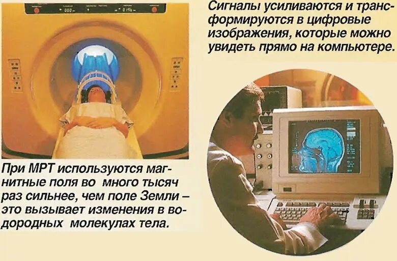 абсолютные противопоказания для проведения мрт. влияние мрт на организм. томография тела. обследование на томографе. влияние мрт на организм.