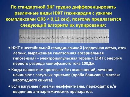 Комплекс узкий