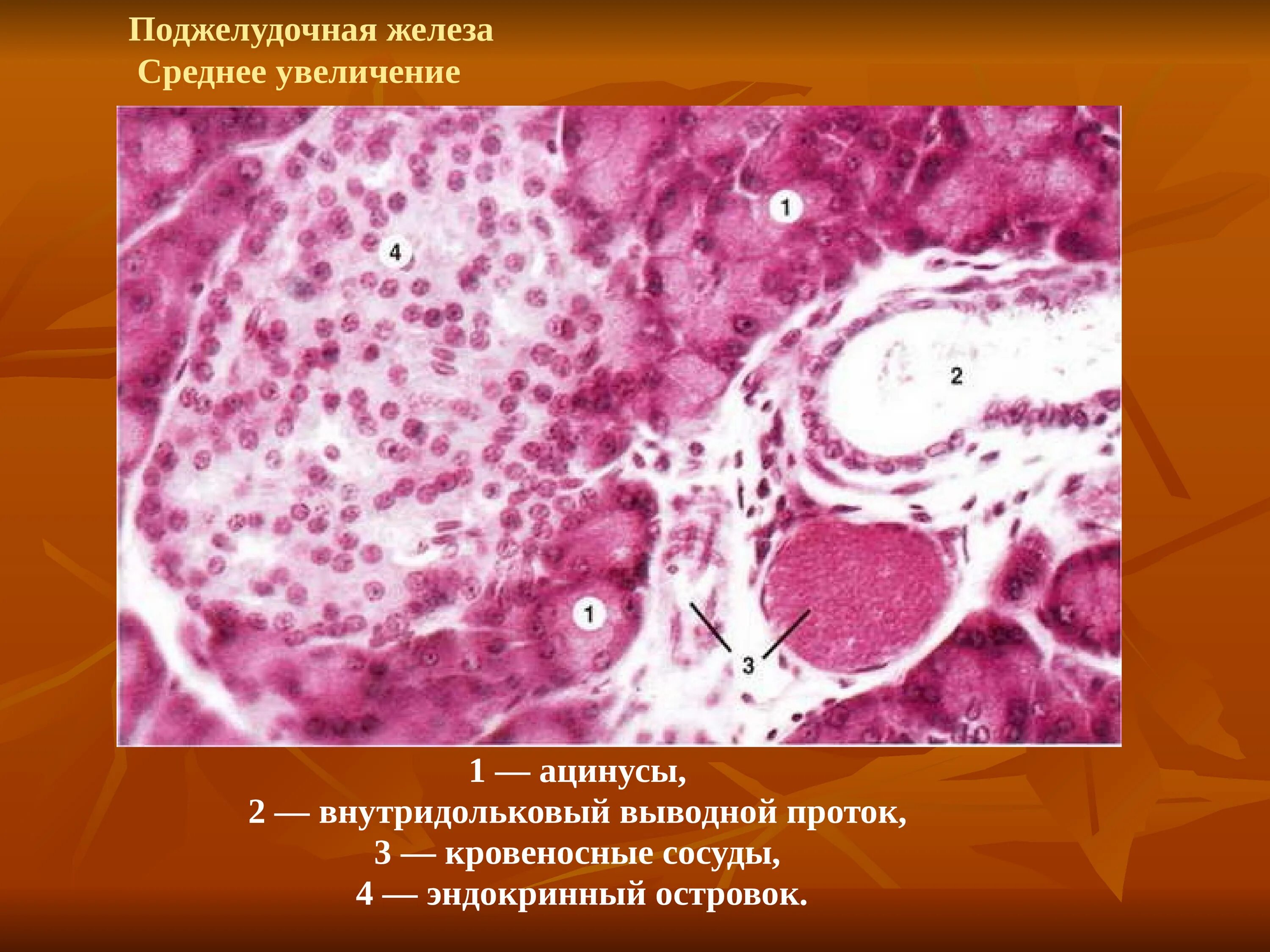 Эпителий печени и поджелудочной железы. Цистаденома поджелудочной железы гистология. Железы поджелудочной железы гистология. Междольковый выводной проток поджелудочной железы гистология. Поджелудочная железа гистология препарат.