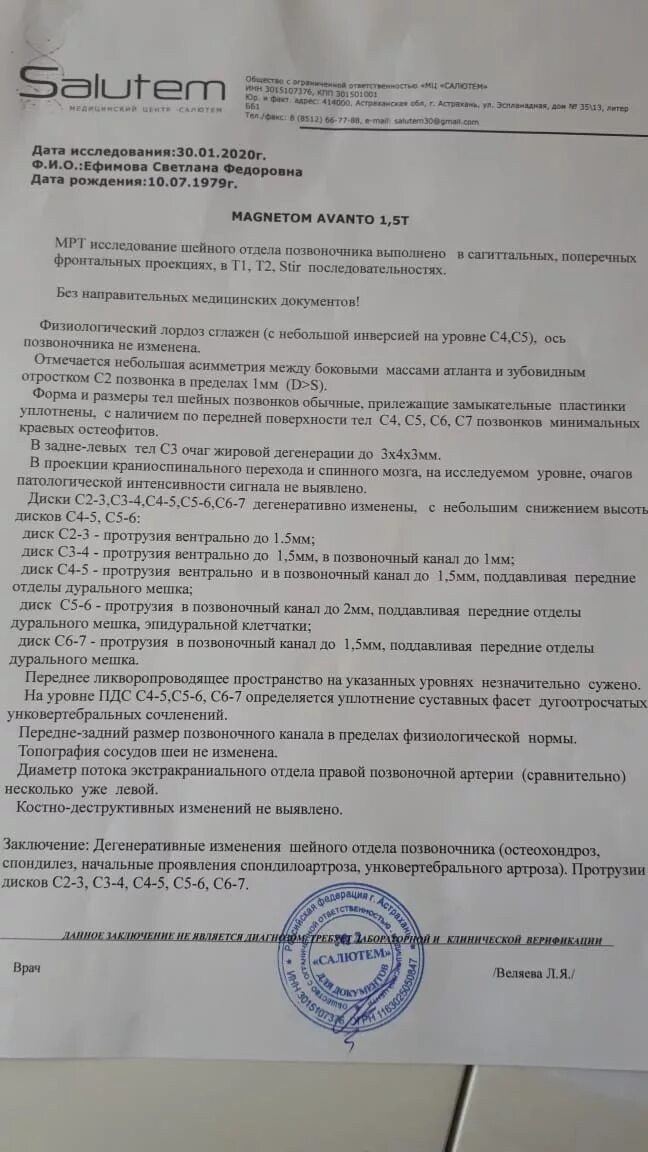 Узи кивательных мышц протокол узи. Узи шейного отдела позвоночника протокол. Направление на мрт шейного отдела. Шейный остеохондроз узи. Узи шейного отдела позвоночника ребенку.