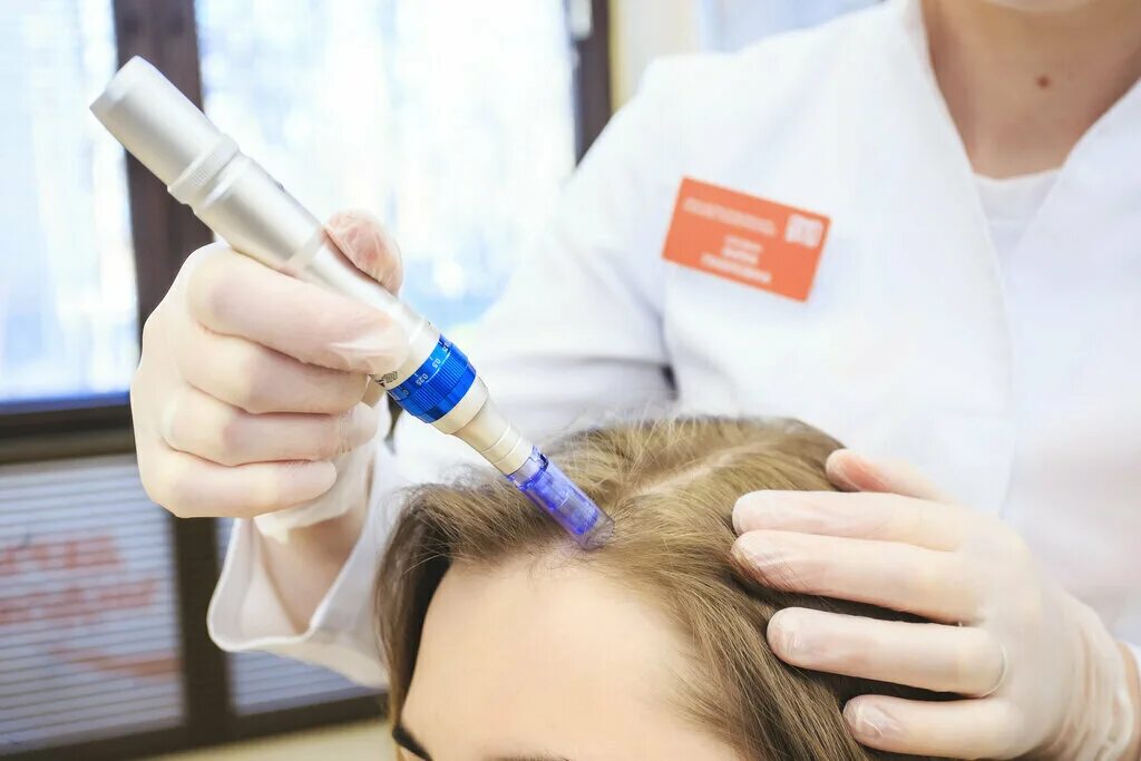 Фракционная микроигольчатая мезотерапия. Фракционная мезотерапия для волос. Мезотерапия волосистой части головы. Фракционнаямезатерапия для волос.
