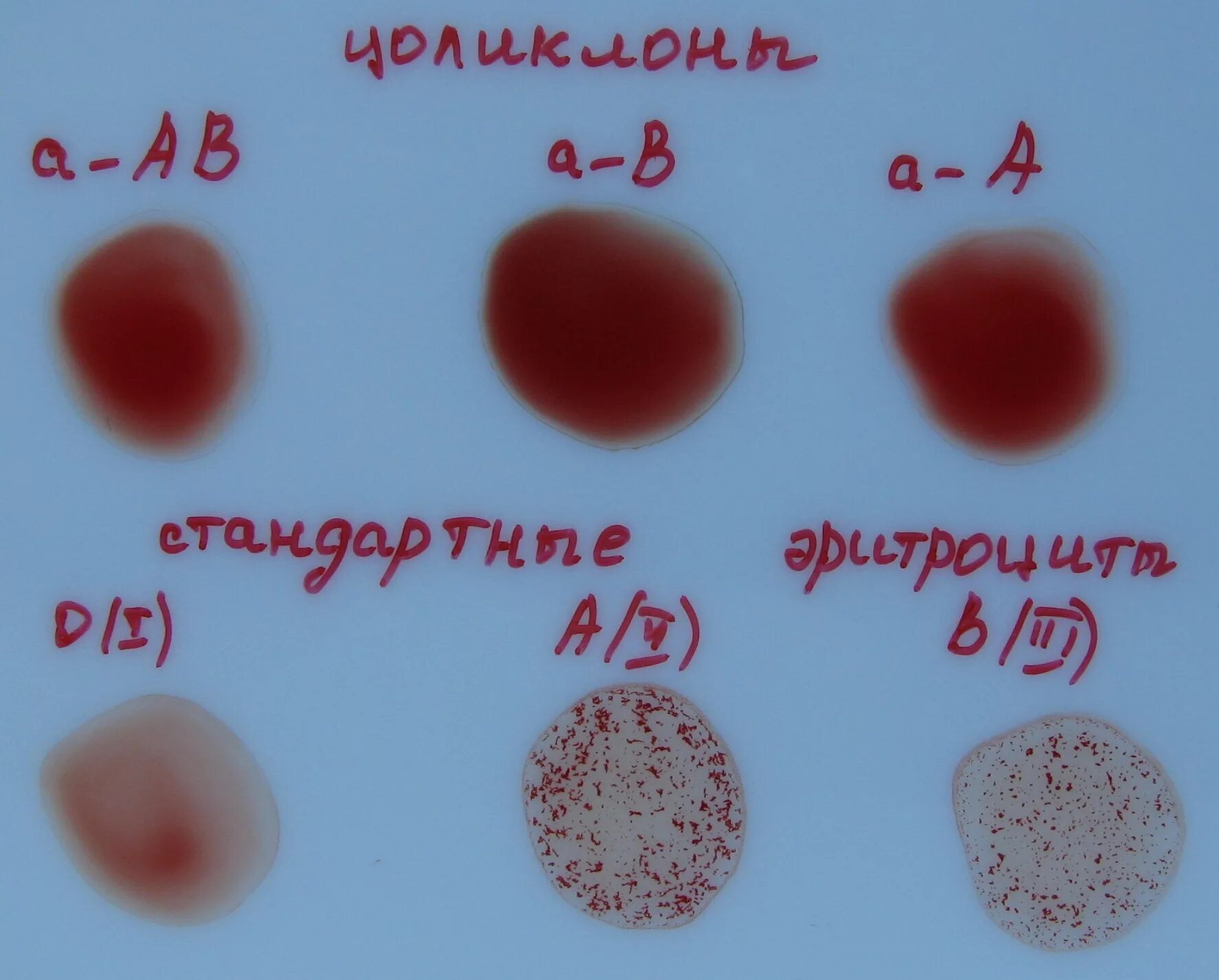 Резус Цоликлоны. Реакция агглютинации резус фактор. Группа крови Цоликлоны резус фактор. Стандартные эритроциты. Группа крови по цоликлонам