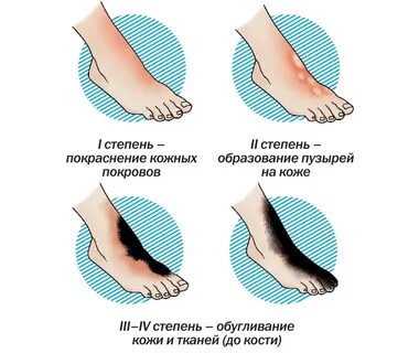 Образования кожи помощь