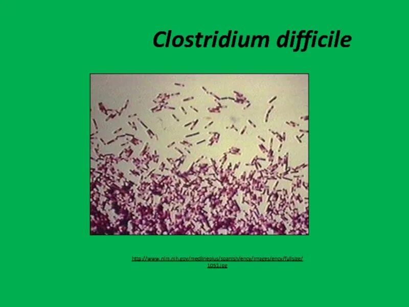 Clostridium difficile под микроскопом. Клостридия диффициле под микроскопом. Clostridium difficile псевдомембранозного колита.