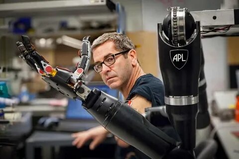Robotics limb