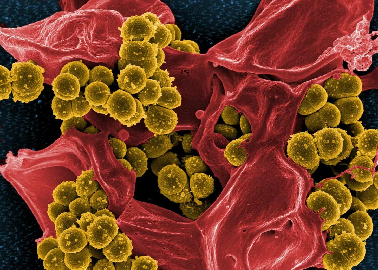 Инфекционные заболевания грибы. Бактерия золотистый стафилококк. Микроб стафилококк. Стафилококк aureus. S. aureus золотистый стафилококк.