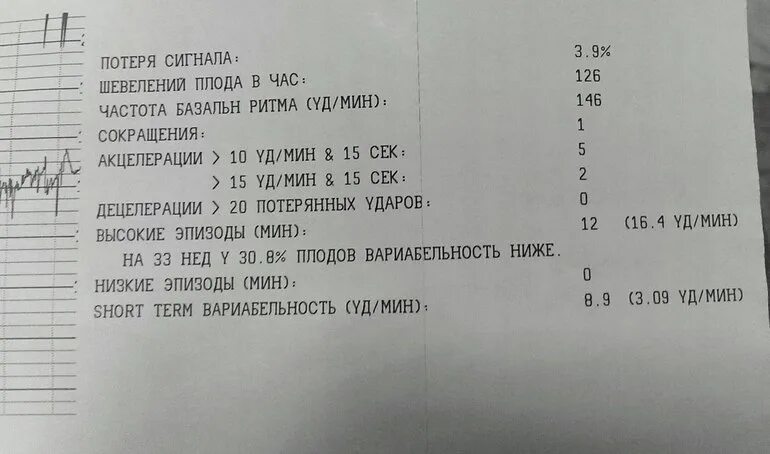 Норма шевелений плода. Норма шевеления ребенка. КТГ шевеления плода в час норма. Шевеления плода на КТГ. Шевеление плода 30 недель