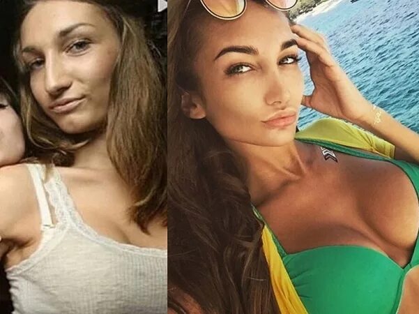 Яна фиткевич до пластики и после фото Как повлияли пластические операции на внешность Элины Карякиной (слухи). Обсужд