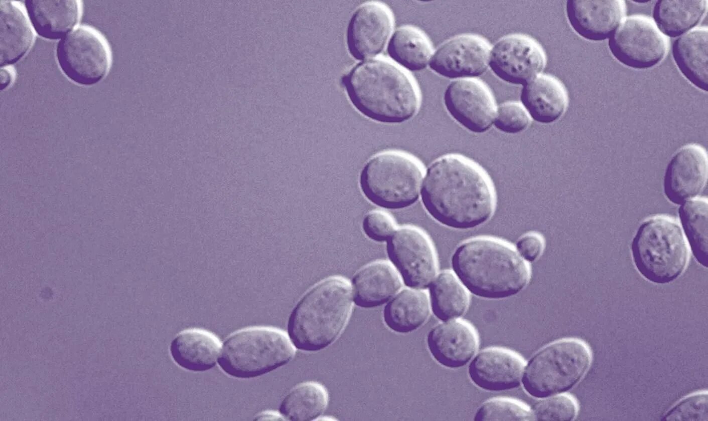 Оборудование для изучения клеток дрожжевых грибов. Дрожжи Saccharomyces cerevisiae. Saccharomyces cerevisiae колонии. Почкование дрожжей под микроскопом. Дрожжей Saccharomyces cerevisiae микроскопия.