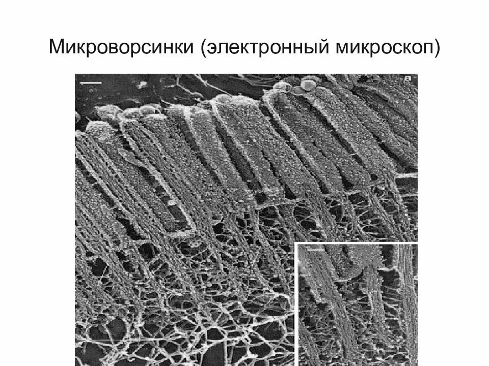Микроворсинки гистология. Строение микроворсинок гистология. строение микроворсинки гистология. микроворсинки гистология функции. щеточная кайма гистология.