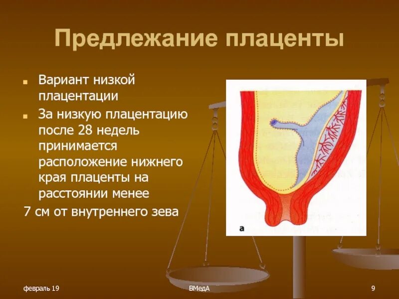 Полное предлежание форум. Шеечное предлежание плаценты. Предлежание плаценты норма. Низкая плацентация. Тазовое предлежание плаценты.