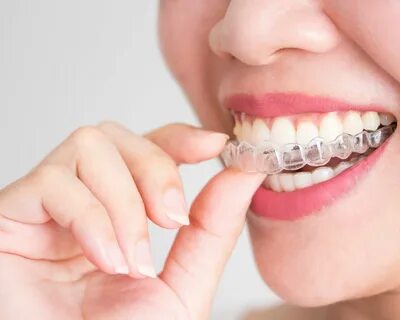 Visit Healthy Smiles to know which one is better for your teeth- Invisalign...
