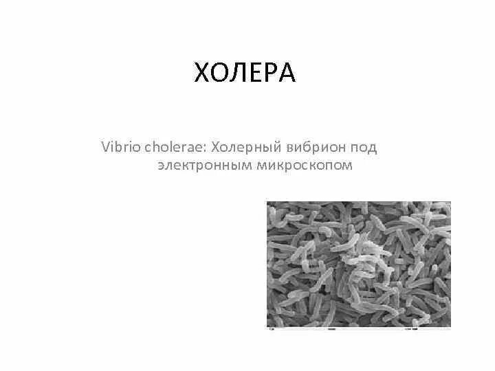 Известно что холерный вибрион вид подвижных. Холерный вибрион электронная микроскопия. Вибрионы под электронным микроскопом. Холерный вибрион в микроскопе. Vibriocholera под микроскопом.
